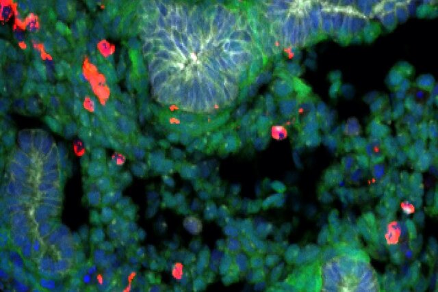 ساخت ریه با سلولهای بنیادی موش